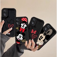 Mickey Minnie Logo Case For honor X9D X9C SMART X9B X9A X8C X8B X8A X7A X7B X6A X8 MAGIC 7 LITE Cute
