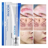 ▣∏✖  Herb Surgical Burn Scar Removal Ointment Gel Acne  Promote Cell Regeneration Repair Cream Whitening Pigmentation Corrector