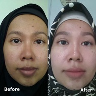 zalfa Natural Skincare Paket lightening series RR