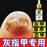 灰甲修复液 灰甲护理修复液 30ml 修复灰甲 Kulat kuku kaki dan tangan Nail fungus treatment