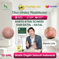 Obat Penyakit Kudis/Budug Obat Scabies Manusia Skabies Atau Kudis Salep Kadas Kudis Di Tangan Dan Ka