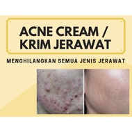Acne CREAM/ACNE CREAM