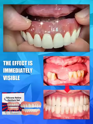 False Teeth Silicone Upper Lower Veneers Perfect Laugh Veneers Dentures Paste Fake Teeth Braces Comf
