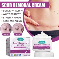 SWEETRIP Scar Removal Cream Peklat Remover Acne Treatment Scar Remover Cream Stretch Marks Removal s
