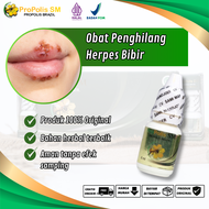 ProPolis SM - Obat Herpes Bibir Luka Melepuh Sekitar Bibir Bintik Putih Infeksi Jamur Di Bibir Binti