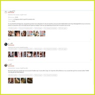 ➯ ➖ ✅ Contractubex Gel 20g Acne Scars Removal |Made in Germany|