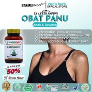 obat panu paling ampuh asli obat panu kadas kurap paling ampuh obat panu paling ampuh permanen obat 