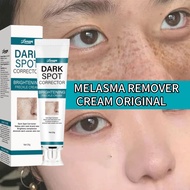 Dark Spot Freckle Cream Melasma Whitening Remover Spot
