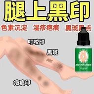 Mosquito Bites Black Marks Black Plain Precipitation Scars Behind Scabs Black Marks Scratches Black 