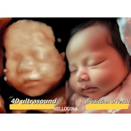 4D ultrasound prediction of baby future photo/Ramalan Rupa Masa Depan Bayi Menggunakan Pemindaian 4d