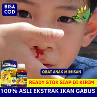 Obat Untuk Anak Mimisan Obat Anak Sering Mimisan Obat Mimisan Terus Menerus Pendarahan Dari Hidung