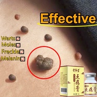 APGAR nevus facial nevus removing ointment Mole Warts removal cream Skin tag removal cream cholester