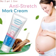Stretch Mark Cream Stretch Mark Cream