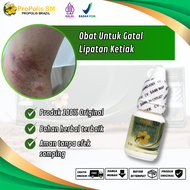 Obat Ketiak Gatal Gatal Lipatan Ketiak Iritasi Ketiak Infeksi Jamur Pada Ketiak Alergi Deodoran Irit