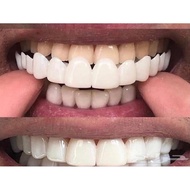 Gigi Palsu Instan Atas Bawah Snap On Smile Original veneer gigi