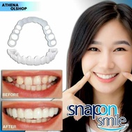 Terlaris Snap On Smile 100% Orinal Authentic / Gi Palsu Snap On Smile