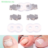 WithBetter   1/2 Set Ingrown Toenail Corrector Tools Pedicure Recover Embed Toenail Treatment Profes