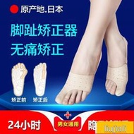 【滿300發貨】分趾器 矯正器 日本品牌拇指外翻矯正器大腳骨外翻腳趾矯正器兒童成人男女可穿鞋