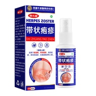 Upgrade herpes simplex shingles snake waist-wrapped spider s#升级单纯疱疹带状疱疹蛇缠腰蜘蛛疮灼烧疼疱疹老牌子426发
