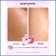 ≅ ∪ ➦ Everwhite Lumibright Series (Brightening Package) - Facial Wash, Toner, Serum With Moisturize