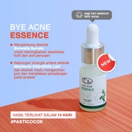 Serum Bye acne essence ella skin care