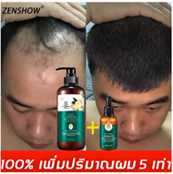 🌙 จัดส่งทันที🌙 ZENSHOW 500ml สูตรน้ำขิง ปลูกผมอย่างอ่อนโยน บำรุงรากผม ผมยาวไว ลดผมหลุดร่วง ยับยั้งรังแค สูตรแก้ปัญหาผมร่วง แชมพูสมุนไพร ยาสระผม anti hair loss shampoo