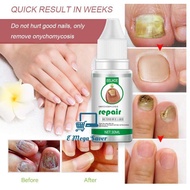 Eelhoe Nail Repair Essence 30ml