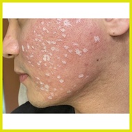 ☌ ♂ ◵ TCA Peel/Cross Solution 100% 15ml