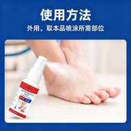 Athlete's Foot Set Athlete's Foot Spray 50ML Athlete's Foot Ointment Care Foot Athlete's Foot Spray