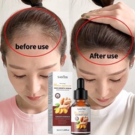 Serum Rambut Lebat Serum Melebatkan Rambut h growth Pelebat Rambut Hair Growth Serum Hair Loss Treat
