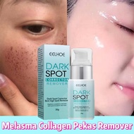 EELHOE Freckle Whitening Cream 30g Dark Spot Remover Cream Moisturizing Brighten Melasma and Pekas Remover Anti Freckle