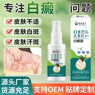 Akito Mikawa White Skin Itchy Skin Itchy White Sweat Spots Sweat Spots Discomfort Spray Ready Stock 