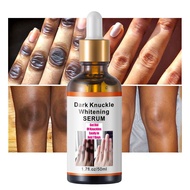 Finger/knee/elbow whitening to remove melanin