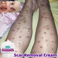 Scar Removal Cream 50G Scar Cream Scar Repair Keloid Scar Removal Stretch Mark Cream Marks Surgical Scars