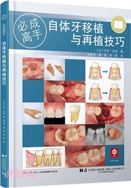 自體牙移植與再植技巧（簡體書）