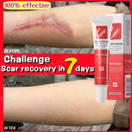 ஐ☸  Herbal Fast Scar Removal Cream Stretch Marks Repair Burn Surgery Skin Treat Keloids Acne Remove Gel Whitening Smooth Skin Care