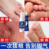 Athlete's Foot Cream Anti-itching Spray Rickling Remove Athlete's Foot Odor Foot Odor Peeling Bad Fo