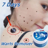 Warts Remover Original Mole And Warts Remover Kasoy Oil Warts Remover Legit Warts Removal Skin Tags 