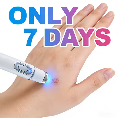 2Laser pen point application wart removal, ᵖᵃⁱⁿˡᵉˢˢ ʷᵃʳᵗ ʳᵉᵐᵒᵛᵃˡ ᵃⁿᵈ ᵖʳᵉᵛᵉⁿᵗ ᵈᵃᵐᵃᵍᵉ