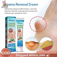 【JC】lipoma cream benjolan ubat benjolan lipoma removal cream Removal Multiple Single Lipoma Subcutan