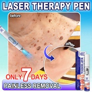 Wart removal laser therapy pen warts removal device kulugo remover