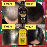 200ML HELLSE Old Ginger King Shampoo Conditioner Anti Hair Loss Dandruff Scalp Care Hair Growth