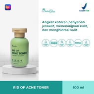 Babies Glow Rid of Acne Toner