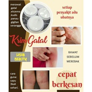 krim gatal / ubat gatal / gatal hilang / kulit sekata / parit hilang / gatal hilang