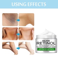 10ml/20ml/30ml Whitening Cream For Body Arms Legs Body Whitening Cream R5p3