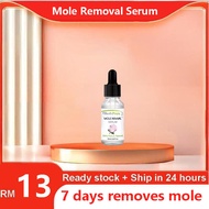 Skin Tag Removal Serum Solution Painless Mole Skin Dark Spot Removal Face Wart Tag Freckle Removal E
