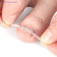 Ingrown Toenail Correction Tools—Professional toenail correction clips/braces for pedicures and ingr