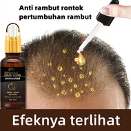 Penumbuh rambut botak Serum penumbuh rambut 30ml Penumbuh rambut