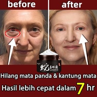 QIANZI untuk Mengurangi Dark Circle Anti-Wrinkle Anti-agging Remover Eye terhadap Puffiness Dan Bags