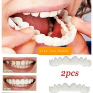 Ready stock 2Pcs Gigi palsu Veneer Teeth upper and bottom